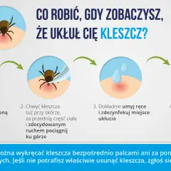 Ilustracja przedstawia cztery etapy usuwania kleszcza: przygotowanie pęsety i alkoholu, chwytanie kleszcza, dezynfekcja miejsca ukłucia i obserwacja.